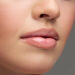 Enhance Your Lips with Volbella Fillers