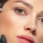Juvederm Filler Dubai