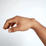 Lipoma Treatment in Dubai