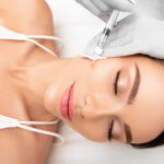 Mesotherapy The Secret to Youthful Looks