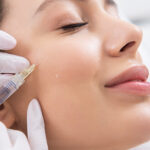 PDRN Treatment Modern Approach to Skin Healing