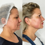 Best Doctors in Dubai for Red Carpet-Ready Transformations
