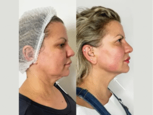 Find the Best Plastic Surgeons in Dubai for Personalized Care