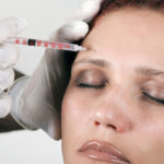 Stem Cell Facelift How It Works and What to Expect