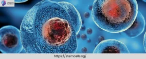 Stem Cell Singapore | Arthritis, Joint Pain & Injection Treatments