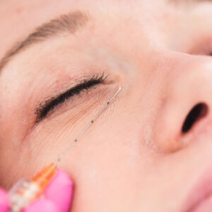 Under Eye Fillers Effective Solutions for Shadows