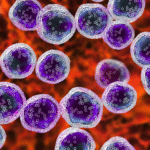 Adult Malignant Glioma Therapeutics Market
