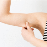 Arm Lift Your Path to Sleek and Beautiful Arms