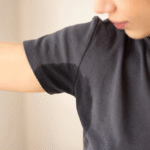 Hyperhidrosis Treatment in Dubai