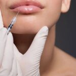 Lip Fillers in Dubai