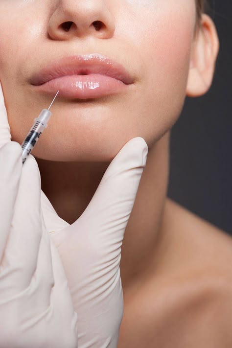 Lip Fillers in Dubai