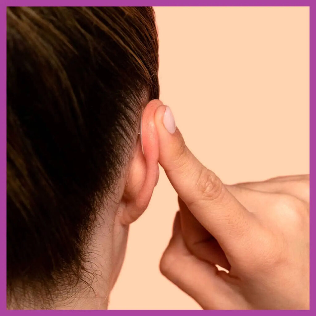 Correct Protruding or Asymmetrical Ears