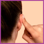 Correct Protruding or Asymmetrical Ears