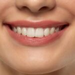 Dimple Creation Surgery in Dubai