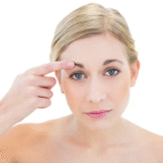 Forehead Lift in Dubai