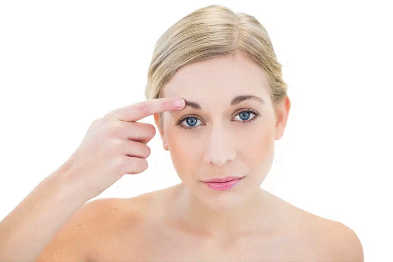 Forehead Lift in Dubai
