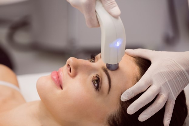 Effective Pico Laser Solutions for Pigmentation