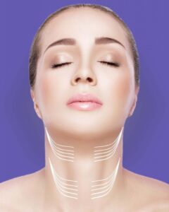Enhance Your Profile with Neck Botox