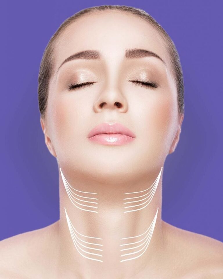 Enhance Your Profile with Neck Botox