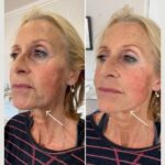 The Best Aesthetic Clinic in Dubai for Personalized Care