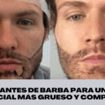 implantes de barba