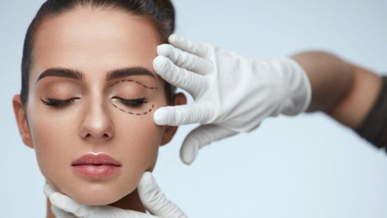 Blepharoplasty Dubai