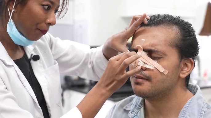 How Rhinoplasty Can Boost Your Confidence