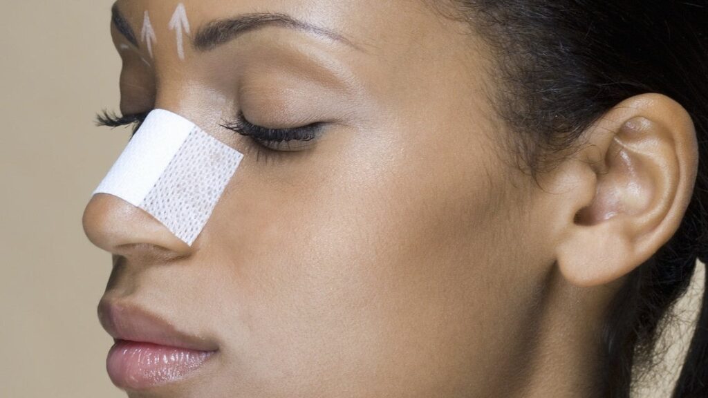 Is Rhinoplasty 100% Safe Option in Dubai