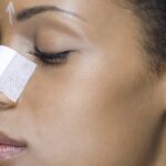 Is Rhinoplasty 100% Safe Option in Dubai