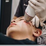 Laser Scar Surgery in Dubai: Patient Safety Guidelines