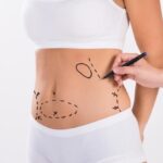 Lipomatic Your Answer to Stubborn Fat
