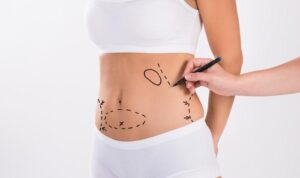 Lipomatic Your Answer to Stubborn Fat