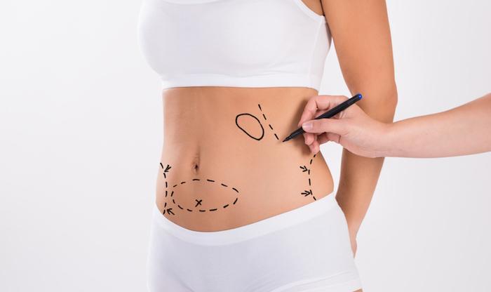 Lipomatic Your Answer to Stubborn Fat