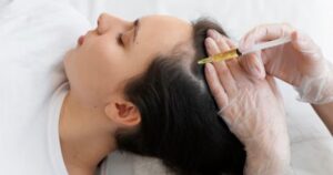 Natural-Looking Hair Restoration