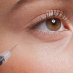 Under-Eye Filler Treatment in Dubai