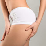Say Goodbye to Sagging Skin with a Lower Body Lift