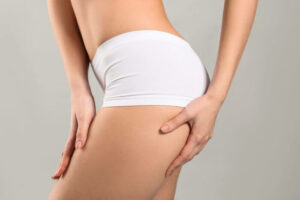 Say Goodbye to Sagging Skin with a Lower Body Lift