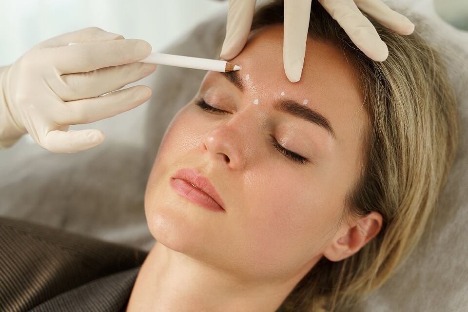 Smooth Fine Lines Without Surgery