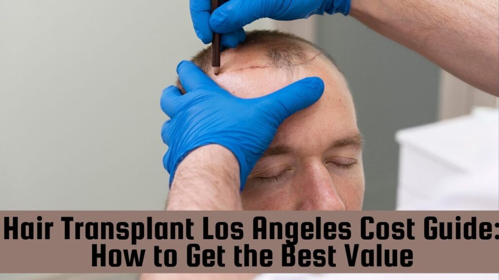 hair transplant los angeles cost