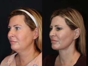 Step Into Confidence with the Best Plastic Surgeons in Dubai