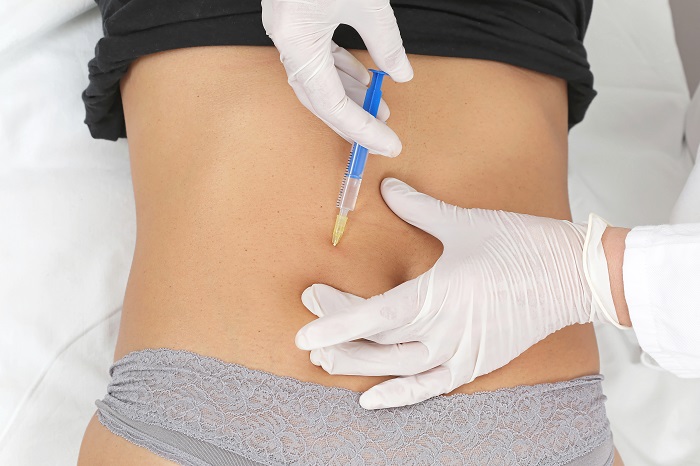 Aqualyx Injection in Dubai