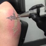 Why PicoSure Is the Gold Standard for Tattoo Removal