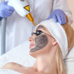 Is Laser Carbon Peel Safe for All Skin Types