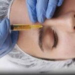 PRP Injections for Anti-Aging