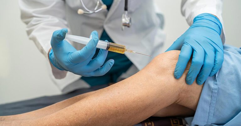 PRP Therapy for Chronic Knee Pain